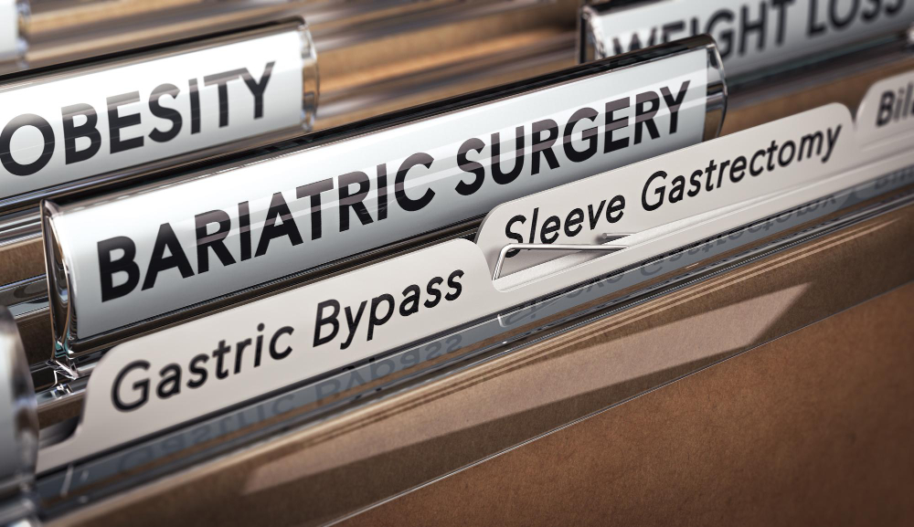 bariatric-surgery-gastric-bypass-sleeve-gastrectomy-types-surgical-operation-used-obesity mini bypass türkei antalya